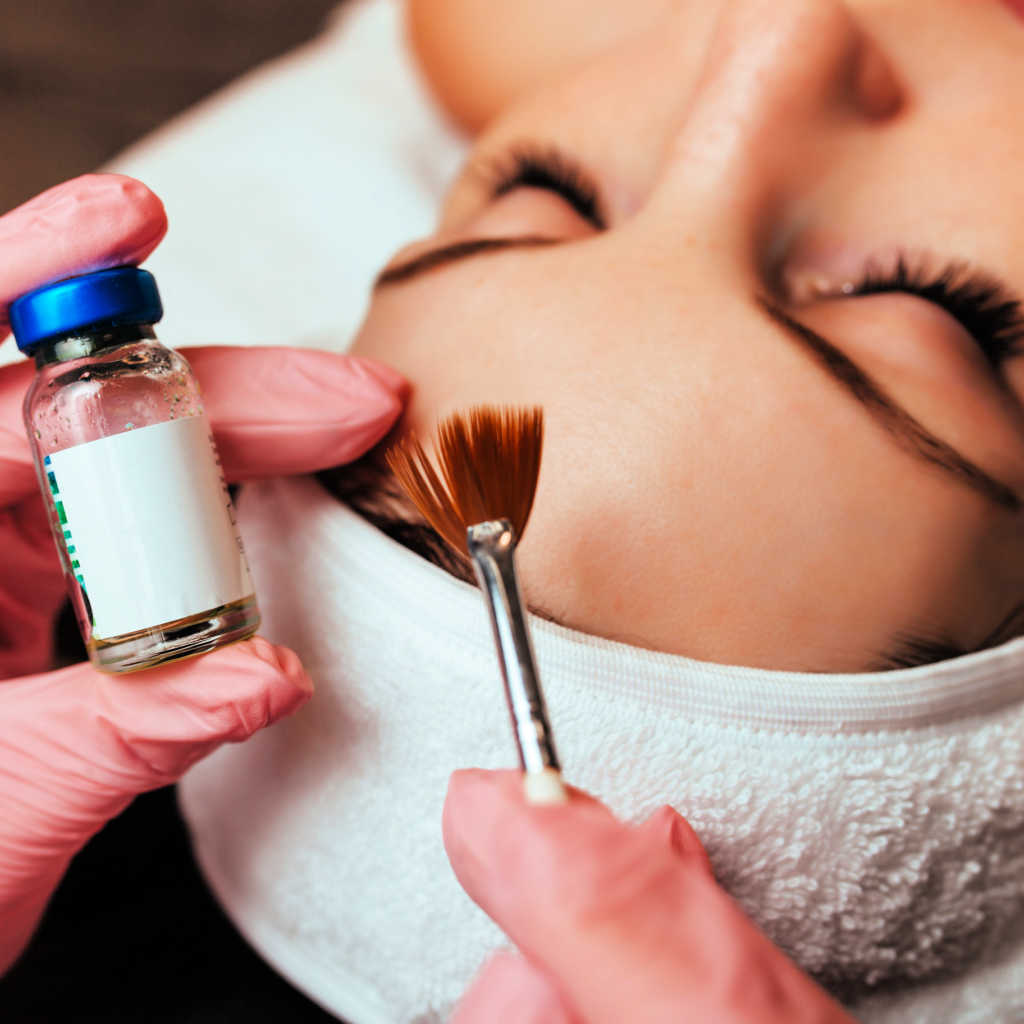 Chemical Peel Being Performed On Spa Luxe Patient